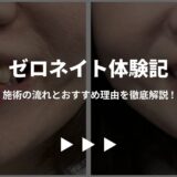 本当に良かった！ゼロネイト体験記 - 施術の流れとおすすめ理由を徹底解説！