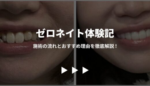 本当に良かった！ゼロネイト体験記 – 施術の流れとおすすめ理由を徹底解説！